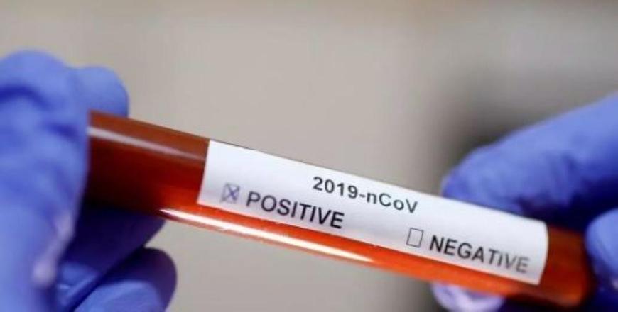 The percentage of positive tests reached 8 per cent, according to Secretary General of the Health Ministry for Epidemics Adel Bilbeisi (JT file photo) 